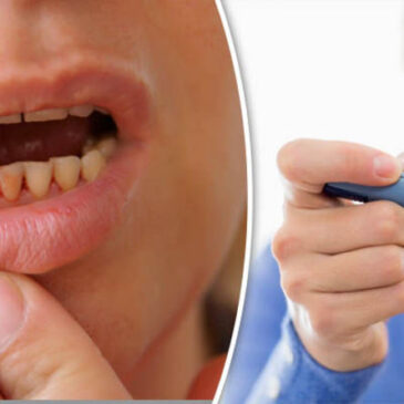 Gum Disease and Diabetes: What You Need to Know